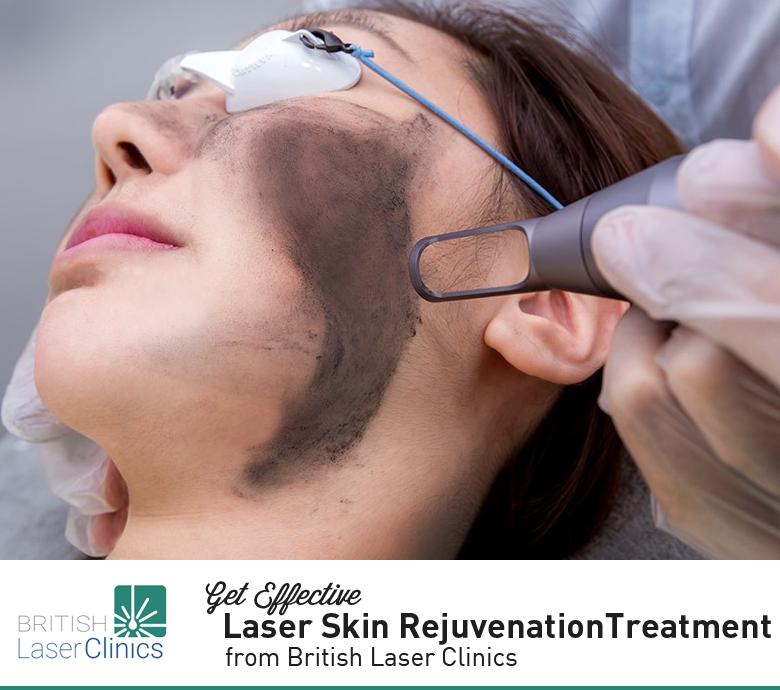 Get Effective Laser Skin RejuvenationTreatment from British Laser Clinics
