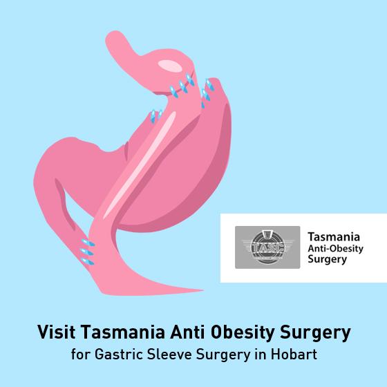 Visit Tasmania Anti Obesity Surgery for Gastric Sleeve Surgery in Hobart