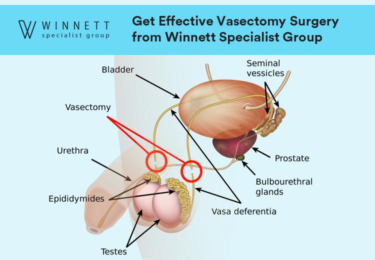 Get Effective Vasectomy Surgery from Winnett Specialist Group