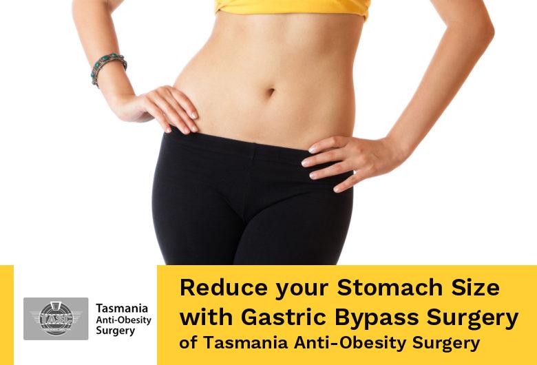 Reduce your Stomach Size with Gastric Bypass Surgery of Tasmania Anti-Obesity Surgery