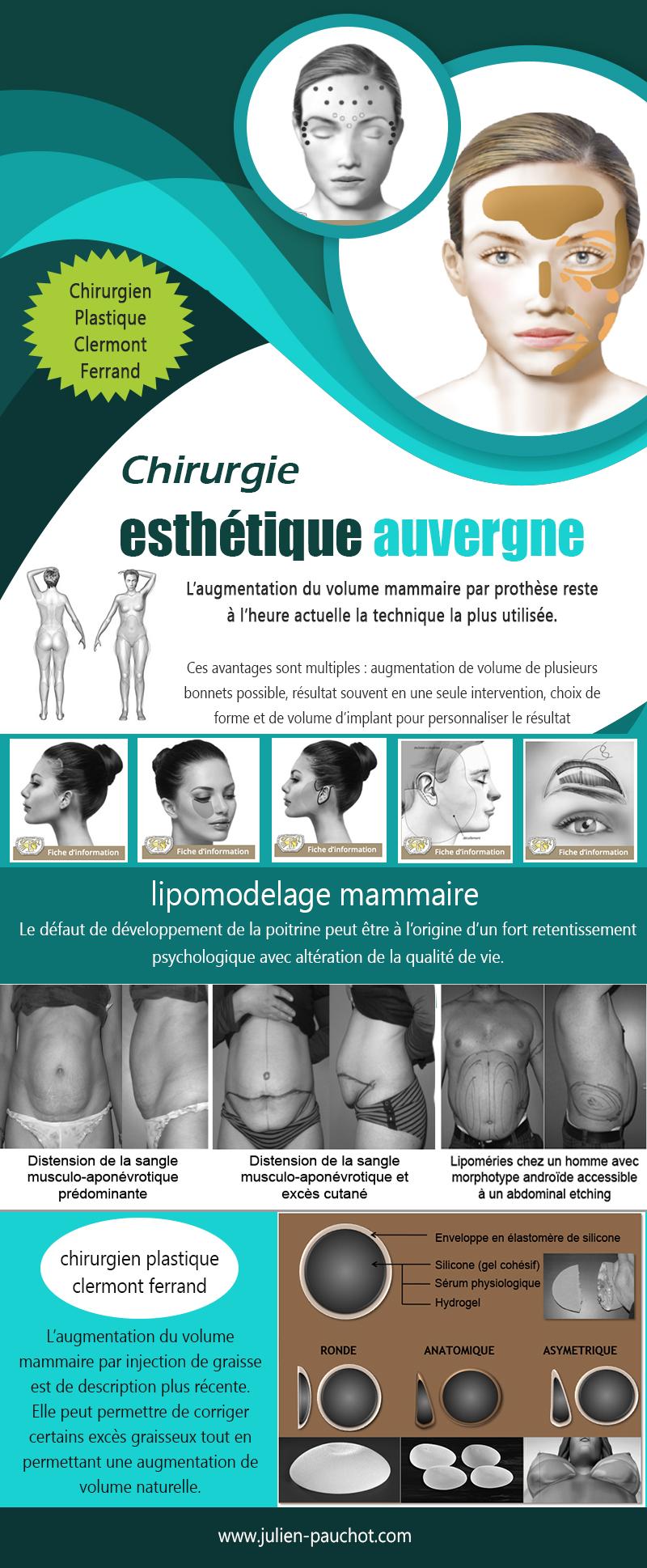 Chirurgie Esthétique Auvergne (2) | http://www.julien-pauchot.com/