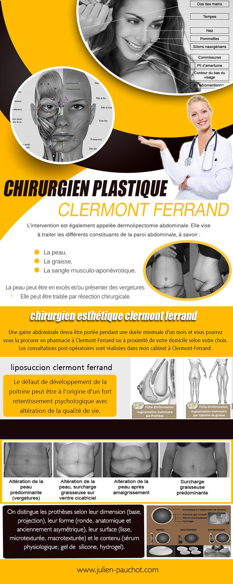 Chirurgien Plastique Clermont Ferrand (2) | http://www.julien-pauchot.com/