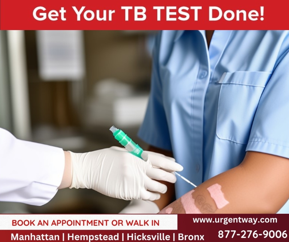GET YOUR TB TEST DONE!