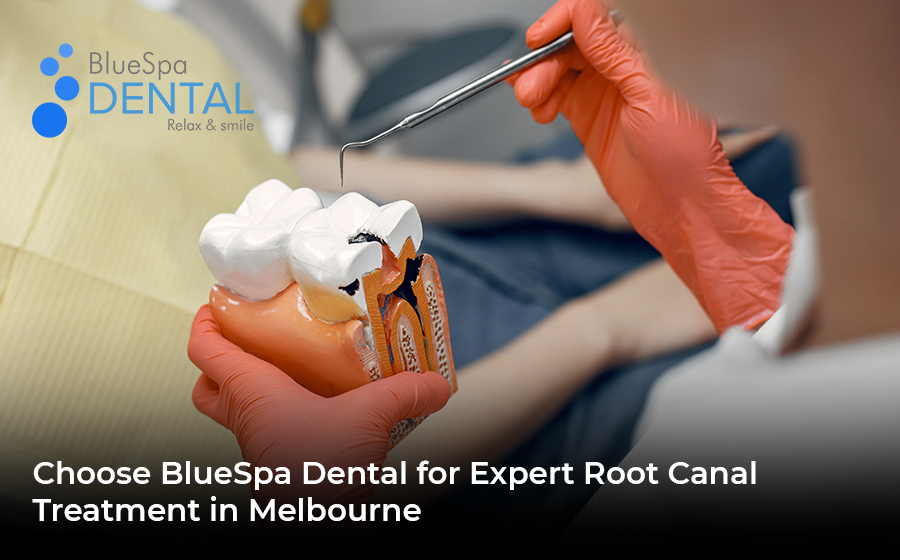 Choose BlueSpa Dental for Expert Root Canal Treatment in Melbourne