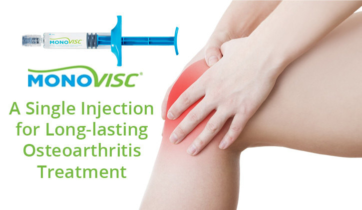 Monovisc - A Single Injection for Long-lasting Osteoarthritis Treatment