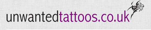 Unwanted Tattoos - Tattoo Removal Clinic