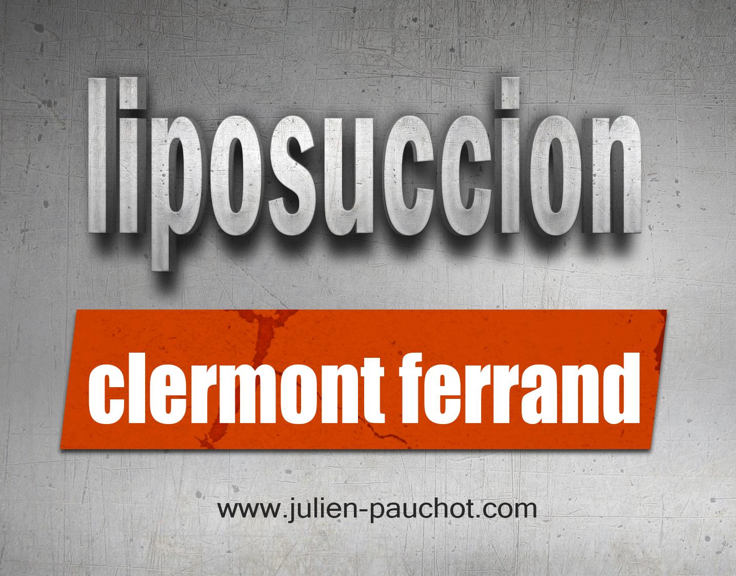 Liposuccion Clermont Ferrand