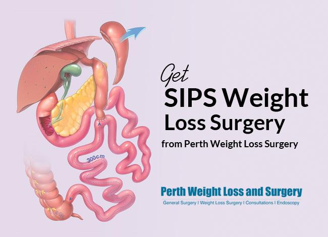 Get SIPS Weight Loss Surgery from Perth Weight Loss Surgery