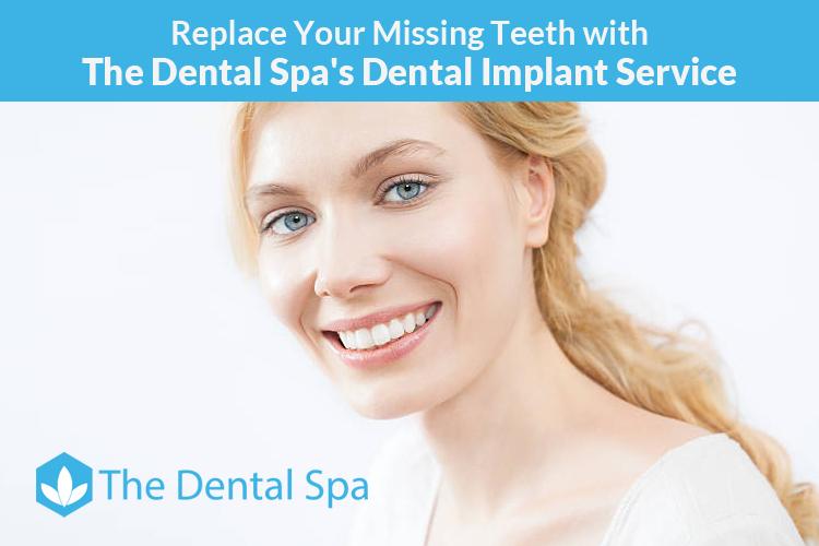 Replace Your Missing Teeth with The Dental Spa’s Dental Implant Service