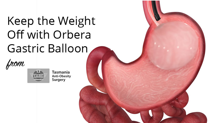 Keep the Weight Off with Orbera Gastric Balloon from Tasmania Anti-Obesity Surgery