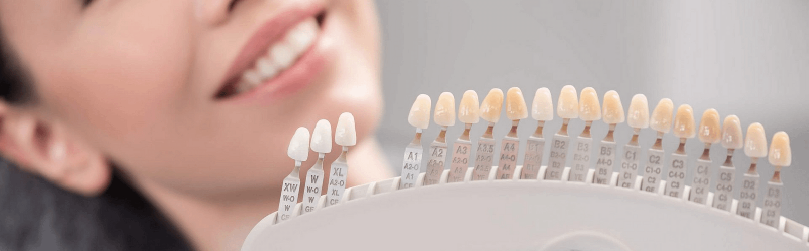 What Are The Different Types Of Dental Crowns? - Gentle Dental Centre Wellington
