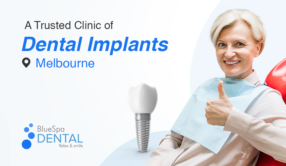 BlueSpa Dental - A Trusted Clinic for Dental Implants in Melbourne