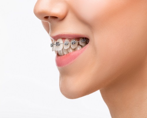 Things to look for before selecting an orthodontist