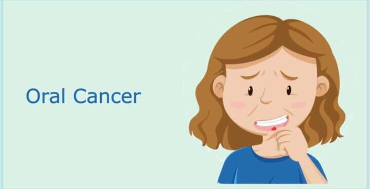 Mouth cancer treatment in Bangalore | Dr. Athira