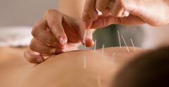 Standard Acupuncture and Chiropractic Treatment provider across 