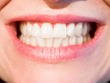 Dentist New West Long Branch | Call - 732 222 0029 | www.drsilm